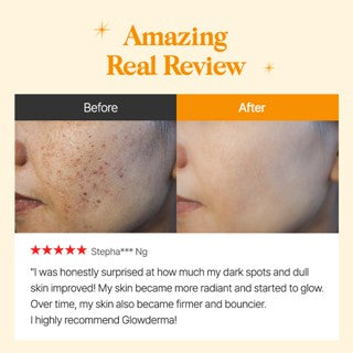 Fillayer L-Glutathione Glow Derma