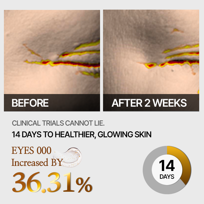 Cellinto Wrinkle TOX 5D Shot